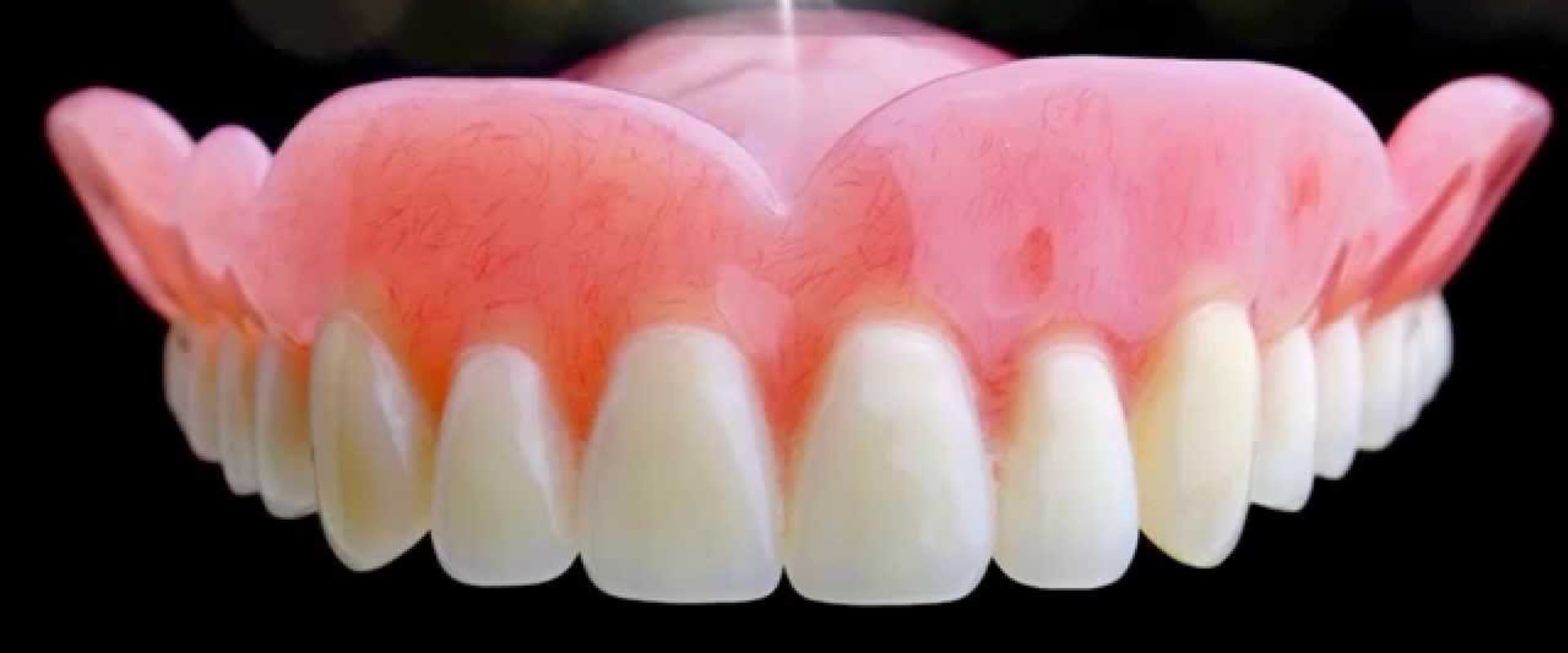 Everything You Need to Know About Dentures and Partial Dentures