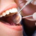 The Benefits of Regular Dental Checkups and Cleanings