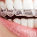 Whitening Strips, Gels, and Pens: A Comprehensive Overview