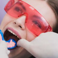The Benefits of Fluoride Treatments for Dental Care