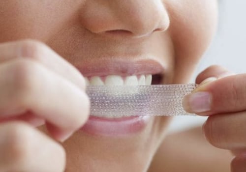 Whitening Strips and Gels Kits - Everything You Need to Know