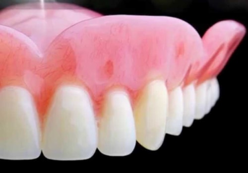 Everything You Need to Know About Dentures and Partial Dentures